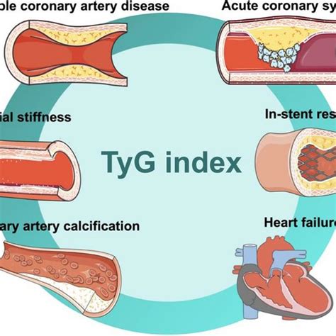 The triglyceride glucose index was U.
